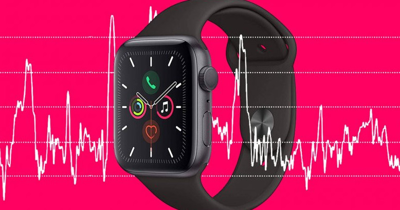 Как синхронизировать mi fit и apple watch